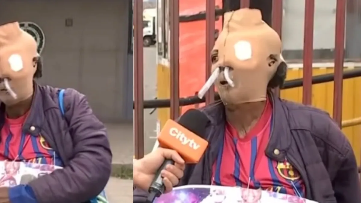 María Consuelo pide eutanasia tras ser víctima de ataque con ácido en Bogotá